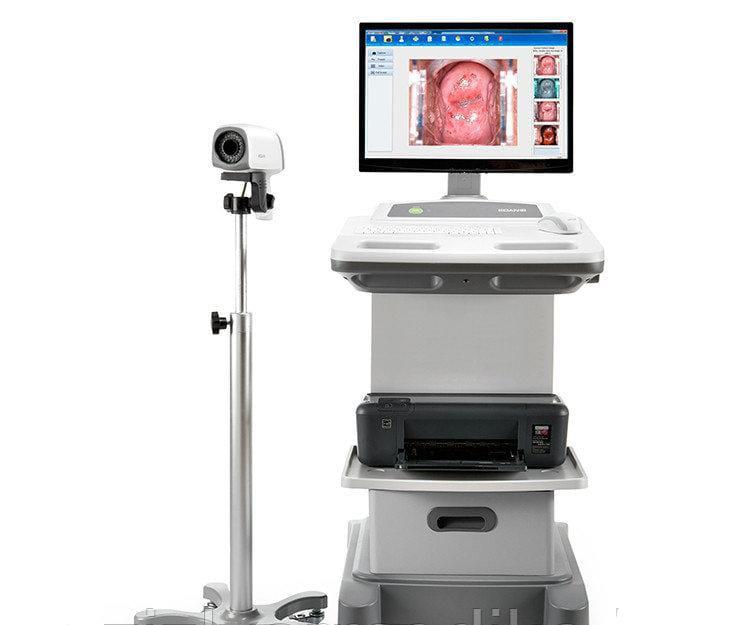 Видеокольпоскоп С6 Edan