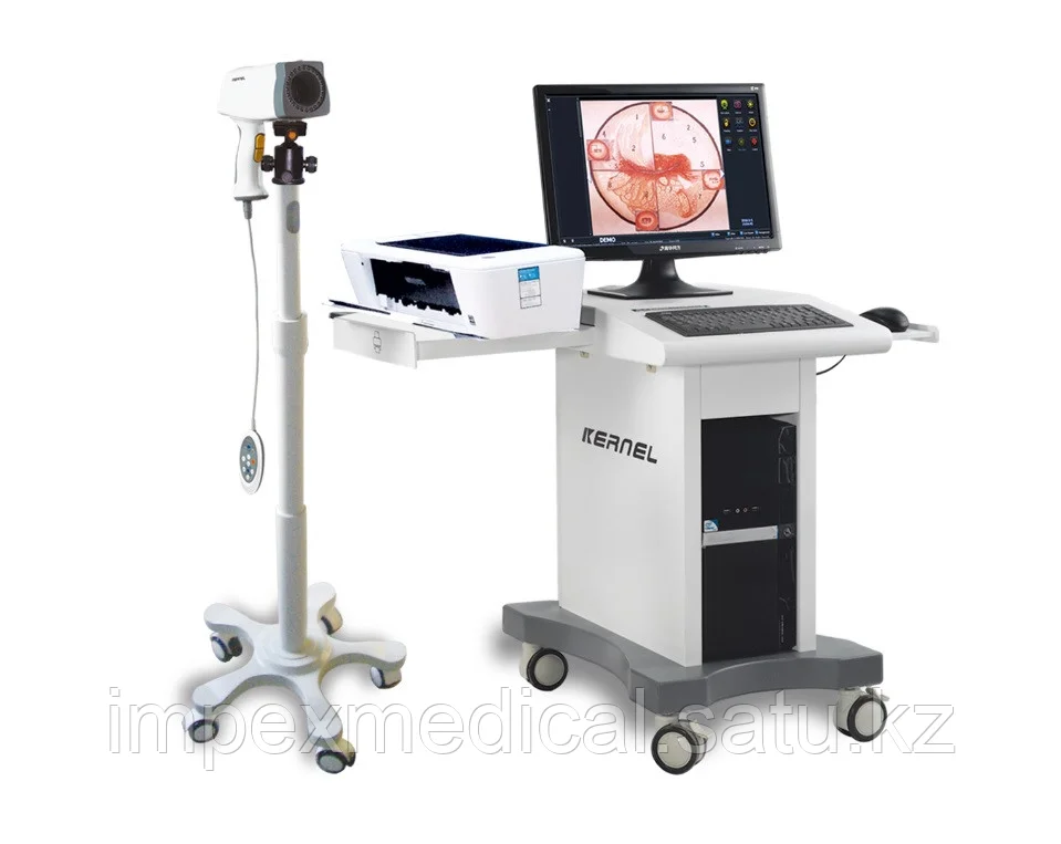 Видеокольпоскоп Kernel KN-2200