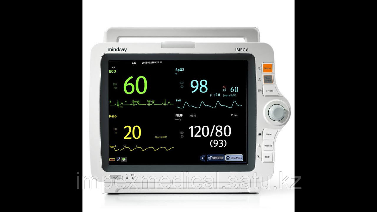 Прикроватный монитор пациента Mindray iMEC 8 с термопринтером
