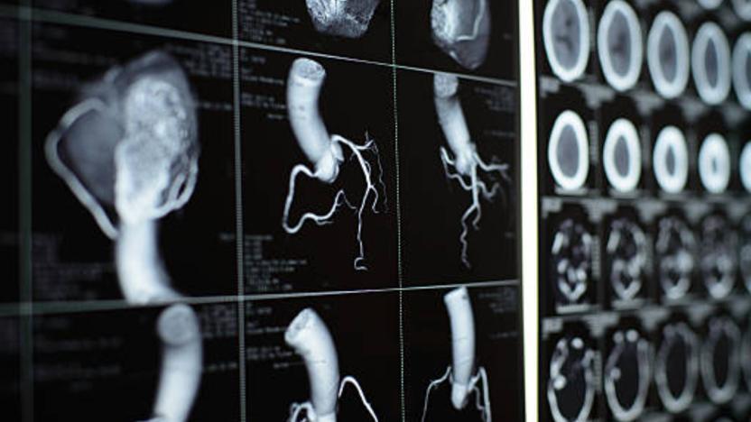 Томограф магнитно-резонансный Siemens magnetom Avanto 1.5t