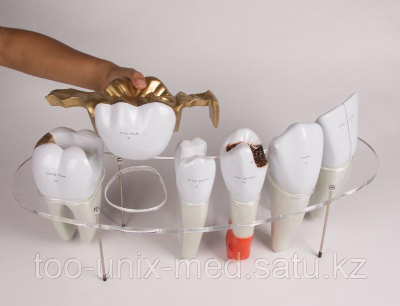 Серия стоматологической морфологии, 7 частей, увеличение в 10 раз