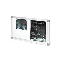 Негатоскоп 2-х кадровый Армед