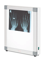 Негатоскоп общего назначения Аrmed 1-кадровый флюоресцентный