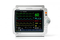 Прикроватный монитор пациента Mindray iMEC 10