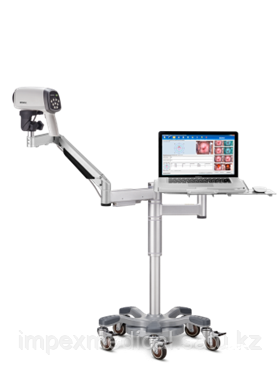 Видеокольпоскоп C6A